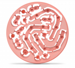Interne Verstärkungen mit TRINIA – Anwendungsbeispiele